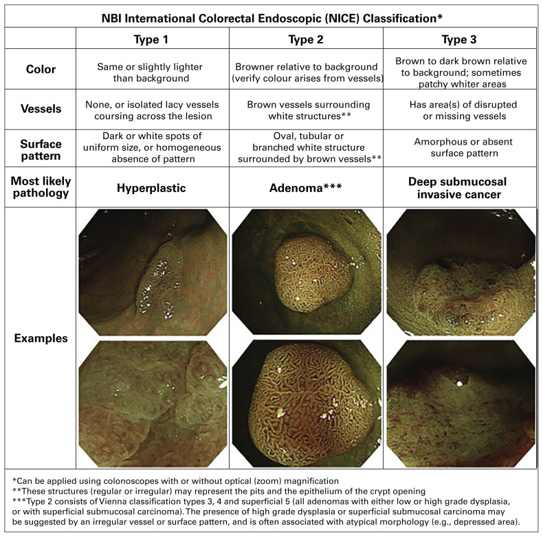 Colorectal polyp classification and management of complex polyps for surgeon endoscopists.