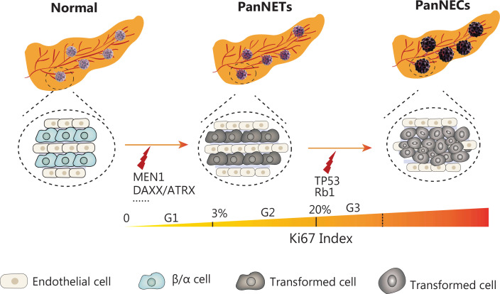 Recent research hotspots in sequencing and the pancreatic neuroendocrine tumor microenvironment.