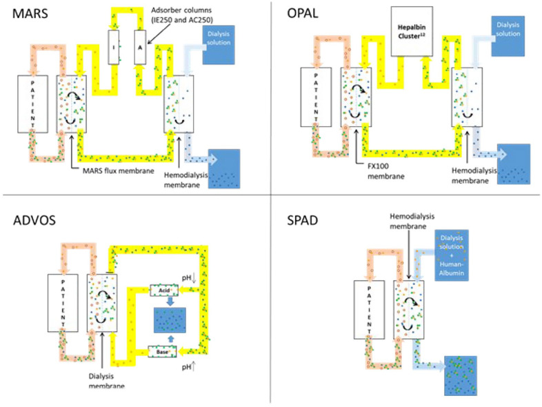 Extracorporeal albumin dialysis in critically ill patients with liver failure: Comparison of four different devices-A retrospective analysis.