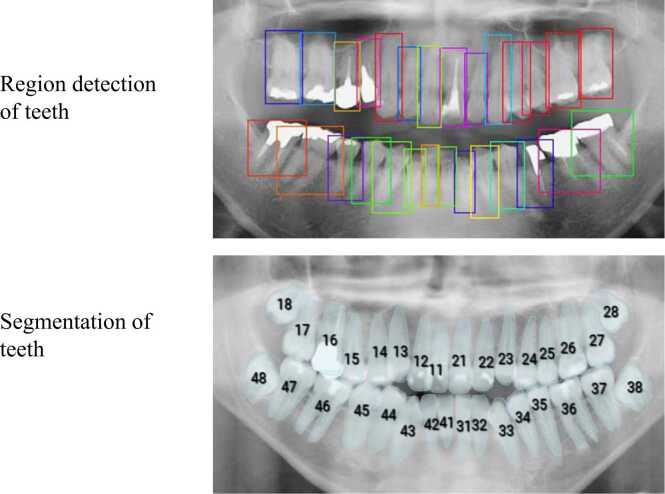 Deep learning and artificial intelligence in dental diagnostic imaging