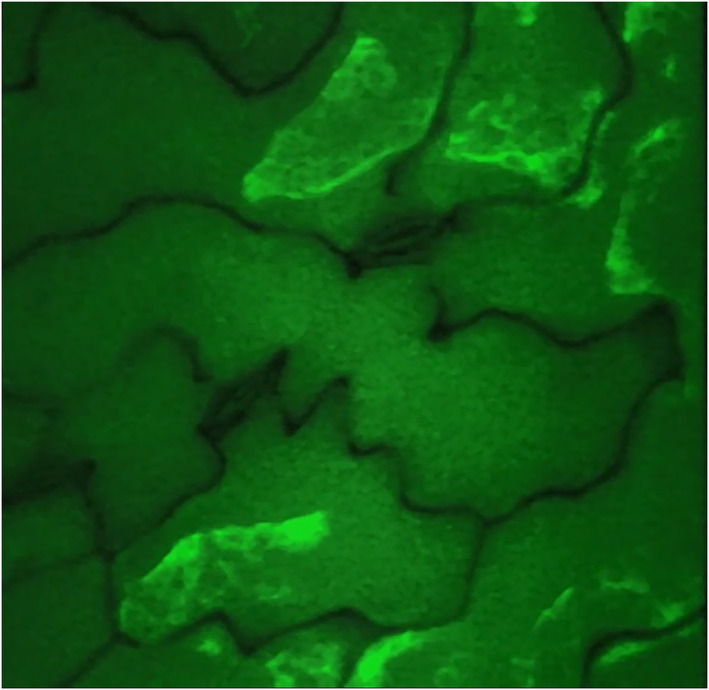 Blue-green fluorescence during hypersensitive cell death arises from phenylpropanoid deydrodimers.