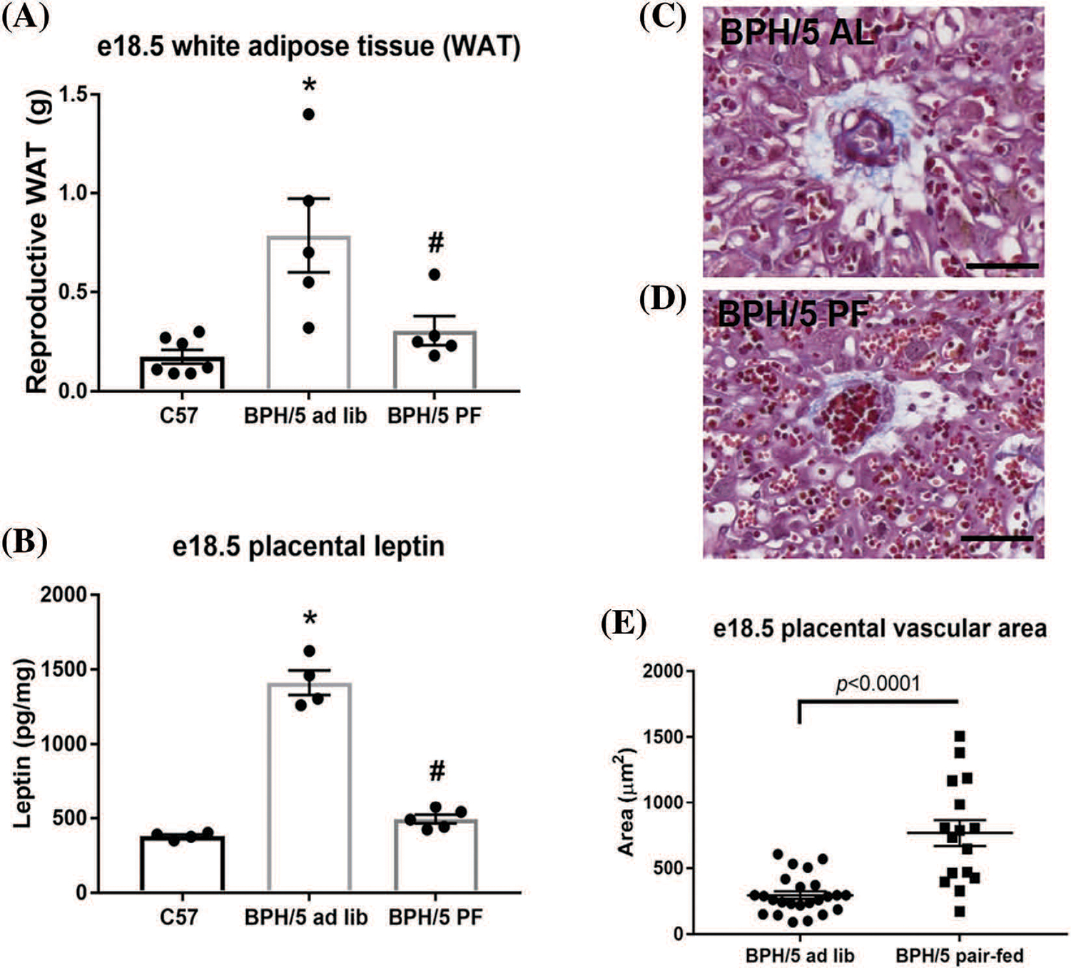 Reversal of maternal obesity attenuates hypoxia and improves placental development in the preeclamptic-like BPH/5 mouse model.