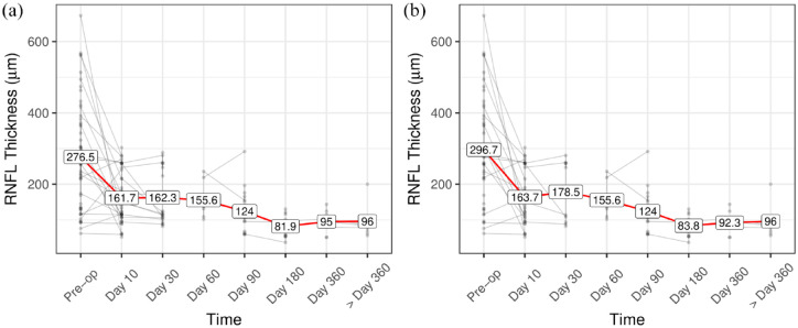 A 20-year multicentre retrospective review of optic nerve sheath fenestration outcomes.