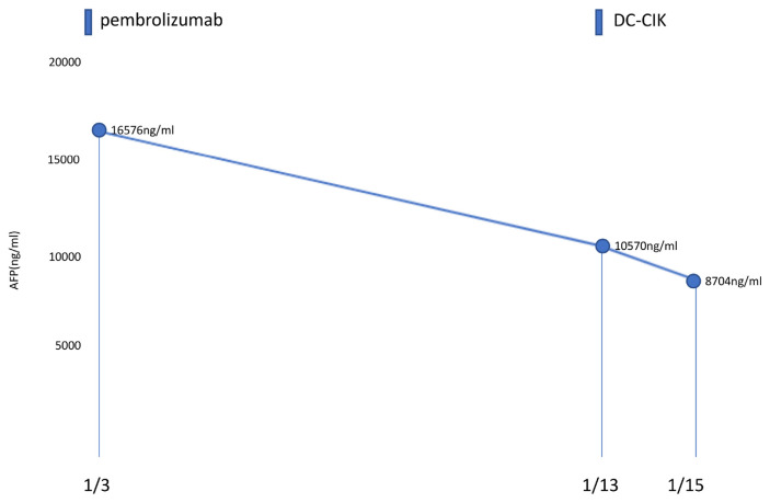 Combination treatment of pembrolizumab with DC-CIK cell therapy for advanced hepatocellular carcinoma: A case report.