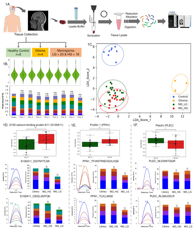 A large-scale targeted proteomics of serum and tissue shows the utility of classifying high grade and low grade meningioma tumors.