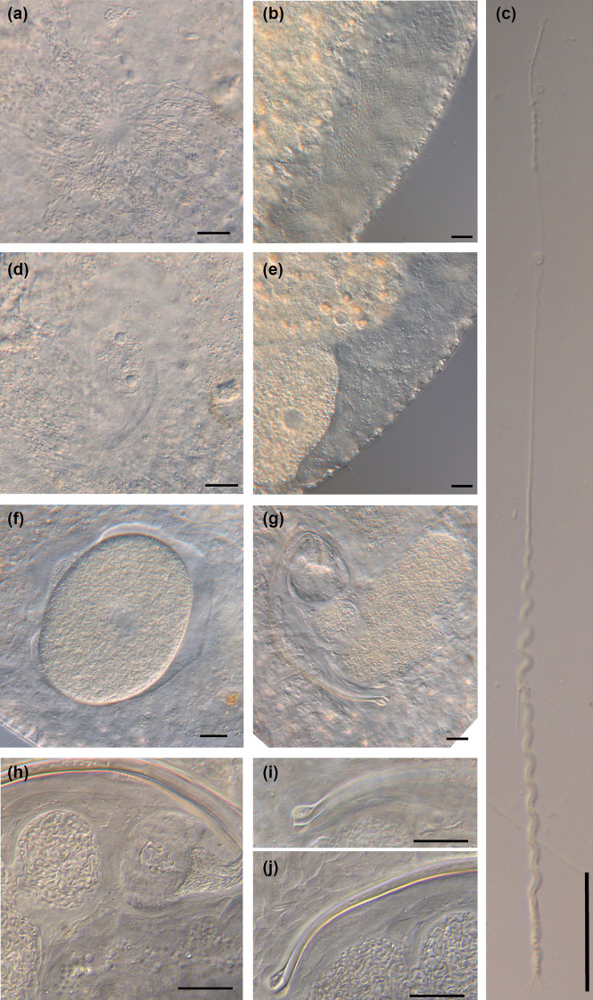 Support for a radiation of free-living flatworms in the African Great Lakes region and the description of five new Macrostomum species.