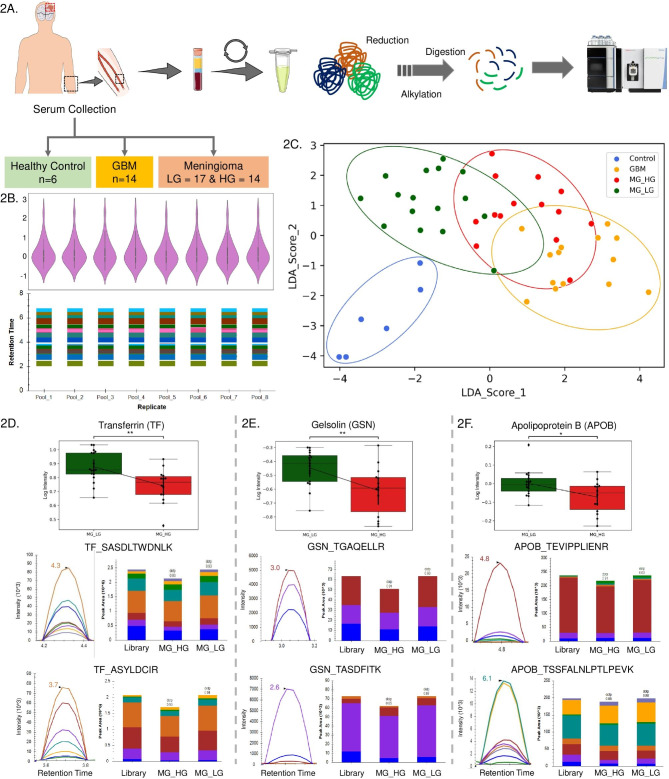 A large-scale targeted proteomics of serum and tissue shows the utility of classifying high grade and low grade meningioma tumors.