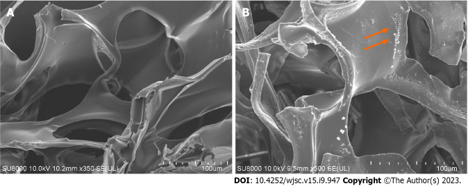 Enhanced wound healing and hemostasis with exosome-loaded gelatin sponges from human umbilical cord mesenchymal stem cells.