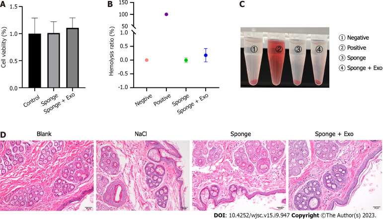 Enhanced wound healing and hemostasis with exosome-loaded gelatin sponges from human umbilical cord mesenchymal stem cells.