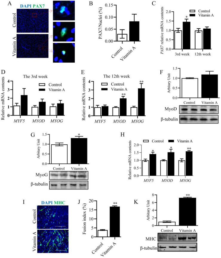 Vitamin A injection at birth improves muscle growth in lambs