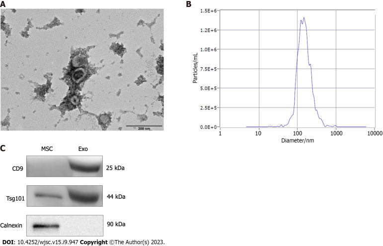 Enhanced wound healing and hemostasis with exosome-loaded gelatin sponges from human umbilical cord mesenchymal stem cells.