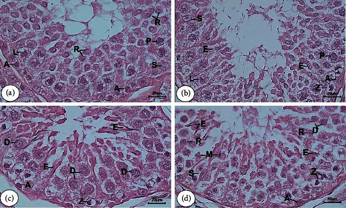 Identification and Determination of the Seminiferous Epithelium Stages and Spermatid Development in the Testis of Aceh Bull (<i>Bos indicus</i>).