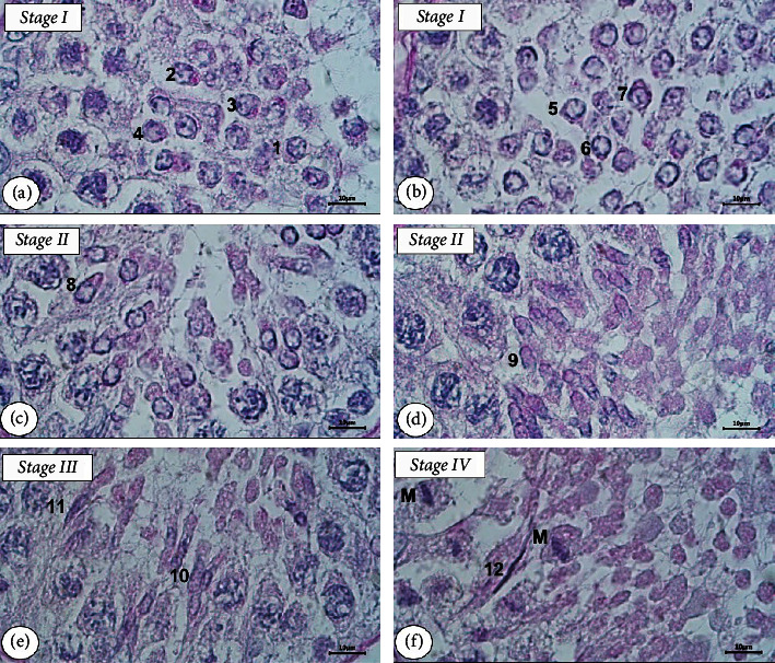 Identification and Determination of the Seminiferous Epithelium Stages and Spermatid Development in the Testis of Aceh Bull (<i>Bos indicus</i>).