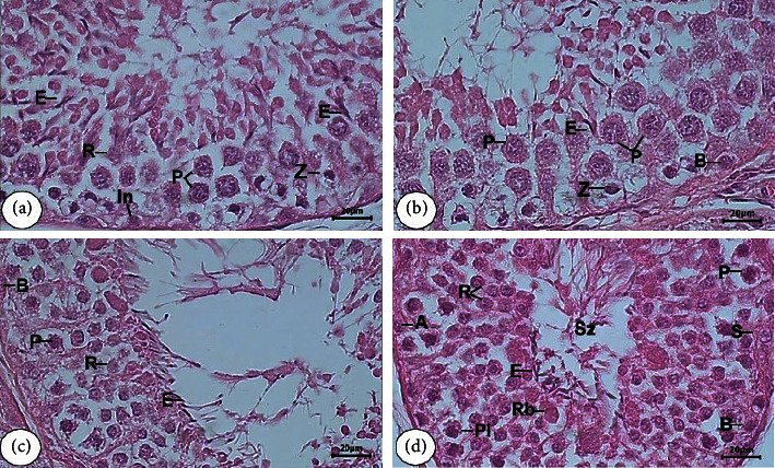 Identification and Determination of the Seminiferous Epithelium Stages and Spermatid Development in the Testis of Aceh Bull (<i>Bos indicus</i>).