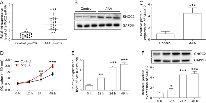 SMOC2 promoted vascular smooth muscle cell proliferation, migration, and extracellular matrix degradation by activating BMP/TGF-β1 signaling pathway.