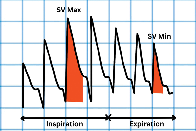 Monitoring Macro- and Microcirculation in the Critically Ill: A Narrative Review.