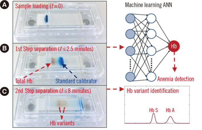 Artificial Intelligence in Point-of-Care Testing.