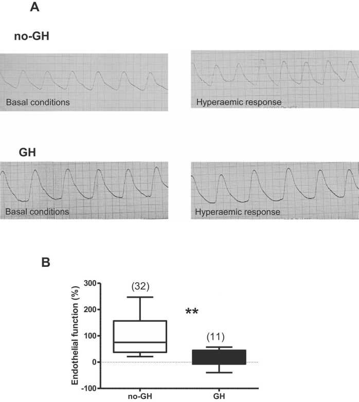 Vascular and autonomic function as early predictive biomarkers of the progression to gestational hypertension