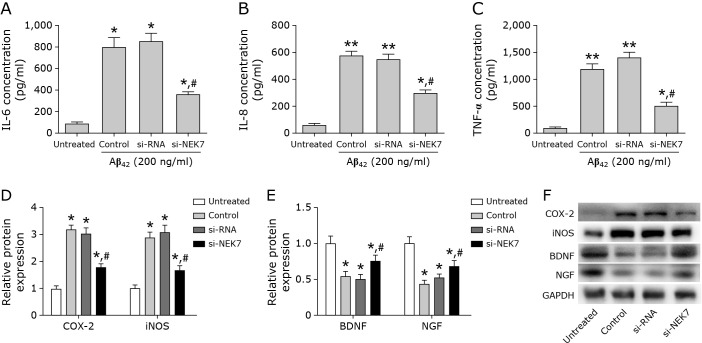 NEK7 inhibition attenuates Aβ<sub>42</sub>-induced cognitive impairment by regulating TLR4/NF-κB and the NLRP3 inflammasome in mice.