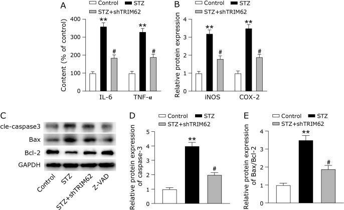 TRIM62 knockdown by inhibiting the TLR4/NF-κB pathway and NLRP3 inflammasome attenuates cognitive impairment induced by diabetes in mice.