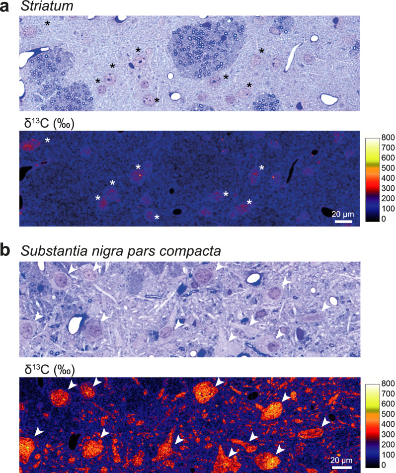 Stable isotope labeling and ultra-high-resolution NanoSIMS imaging reveal alpha-synuclein-induced changes in neuronal metabolism in vivo.