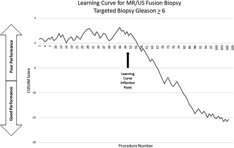 Learning curve for magnetic resonance imaging/ultrasound fusion prostate biopsy in detecting prostate cancer using cumulative sum analysis.