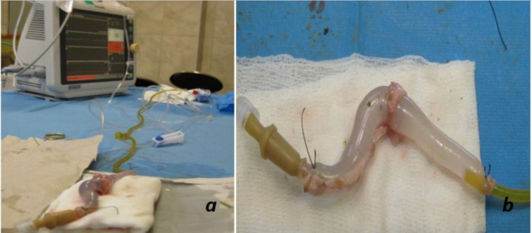 The comparison of the suture materials on intestinal anastomotic healing: an experimental study.