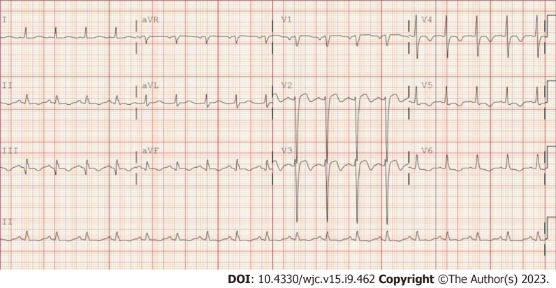 Variant of Wellen's syndrome in type 1 diabetic patient: A case report.