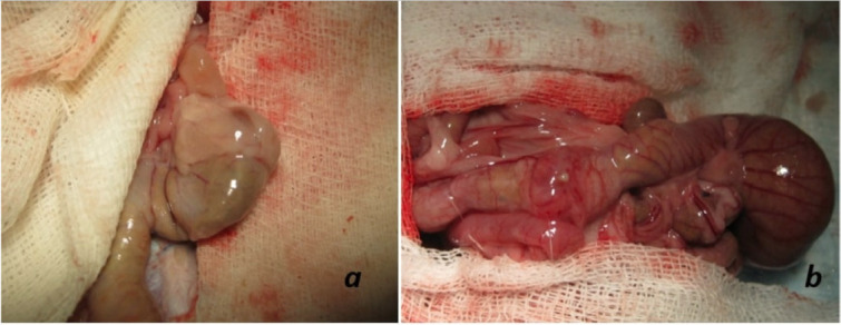 The comparison of the suture materials on intestinal anastomotic healing: an experimental study.