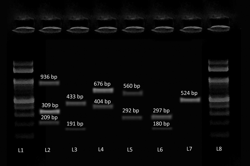 Spectrum of Virulence Factors in Clinical Isolates of <i>Staphylococcus aureus</i> and Prevalence of SCCmec Types in Methicillin-Resistant <i>Staphylococcus aureus</i> in a Tertiary Care Center.