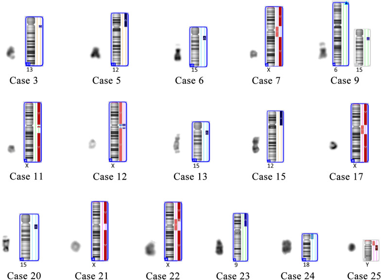 Molecular and cytogenetic analysis of small supernumerary marker chromosomes in prenatal diagnosis.