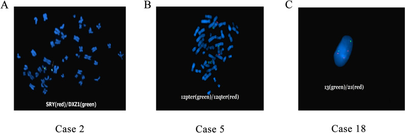 Molecular and cytogenetic analysis of small supernumerary marker chromosomes in prenatal diagnosis.