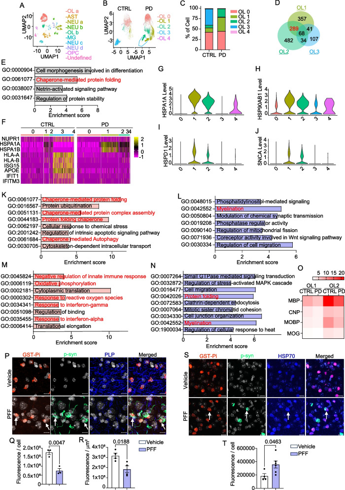 Changes in oligodendroglial subpopulations in Parkinson's disease.