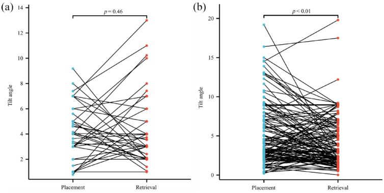 Relationship between vascular access and angulation of vena cava filter at placement and retrieval: a multicenter retrospective cohort study.