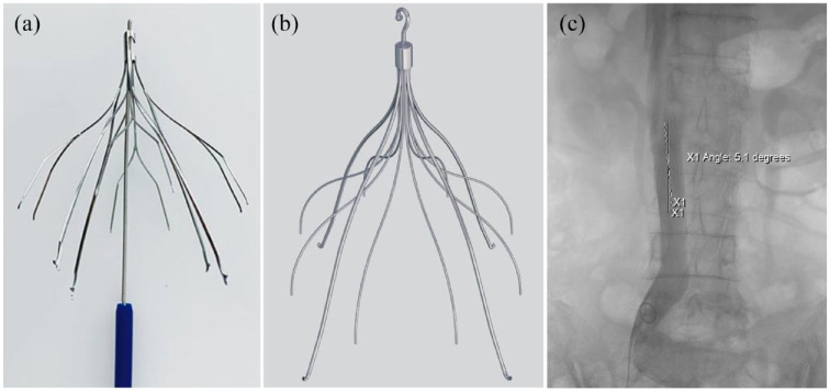 Relationship between vascular access and angulation of vena cava filter at placement and retrieval: a multicenter retrospective cohort study.