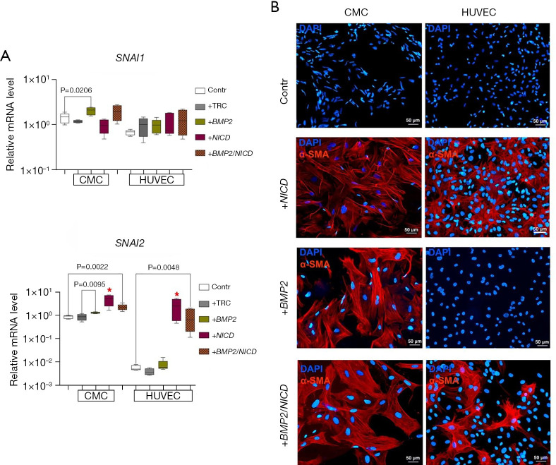 Interplay between BMP2 and Notch signaling in endothelial-mesenchymal transition: implications for cardiac fibrosis.