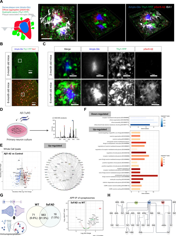 Abnormal accumulation of extracellular vesicles in hippocampal dystrophic axons and regulation by the primary cilia in Alzheimer's disease.