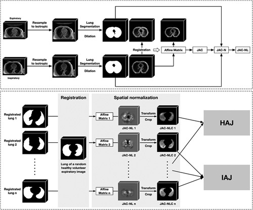 Elastic Registration Algorithm Based on Three-dimensional Pulmonary MRI in Quantitative Assessment of Severity of Idiopathic Pulmonary Fibrosis.