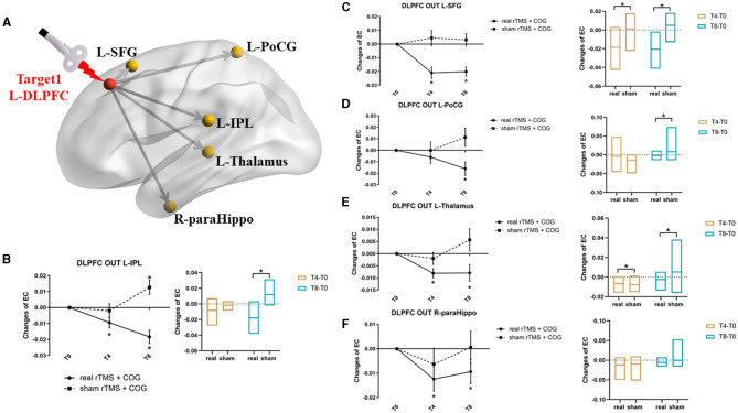 Multisite rTMS combined with cognitive training modulates effective connectivity in patients with Alzheimer's disease.