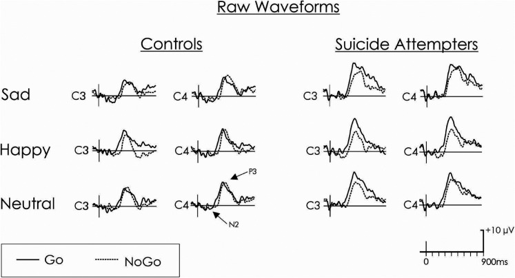 Emotional Modulation of Response Inhibition in Adolescents During Acute Suicidal Crisis: Event-Related Potentials in an Emotional Go/NoGo Task.