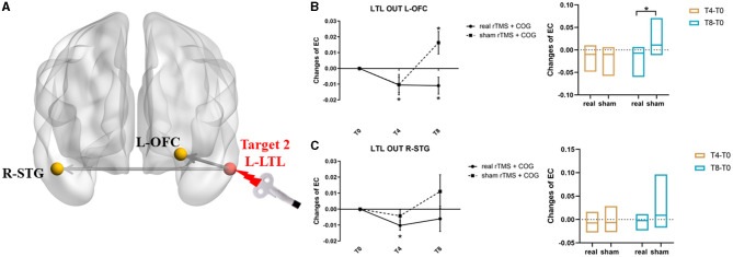 Multisite rTMS combined with cognitive training modulates effective connectivity in patients with Alzheimer's disease.