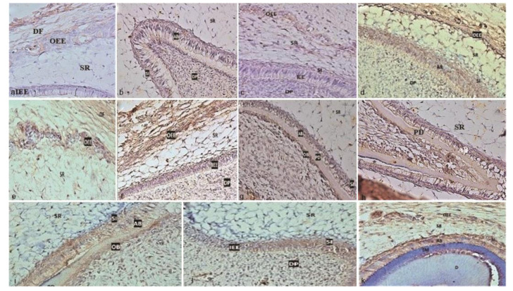 Immunohistochemical Localization of Endothelin- 1 and Endothelin A Receptor in Human Primary Tooth Enamel Organ.