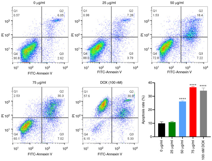 Natural product procyanidin B1 as an antitumor drug for effective therapy of colon cancer.