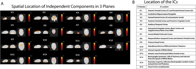 Detection and characterization of resting state functional networks in squirrel monkey brain.