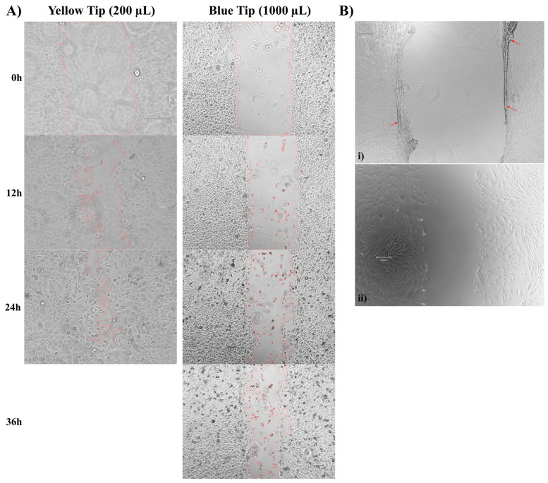 A Robust and Standardized Approach to Quantify Wound Closure Using the Scratch Assay.