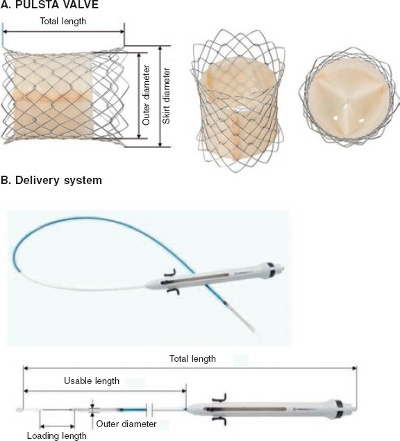 [The PULSTA valve in native right ventricular outflow tract: initial experience in 3 Spanish hospitals].