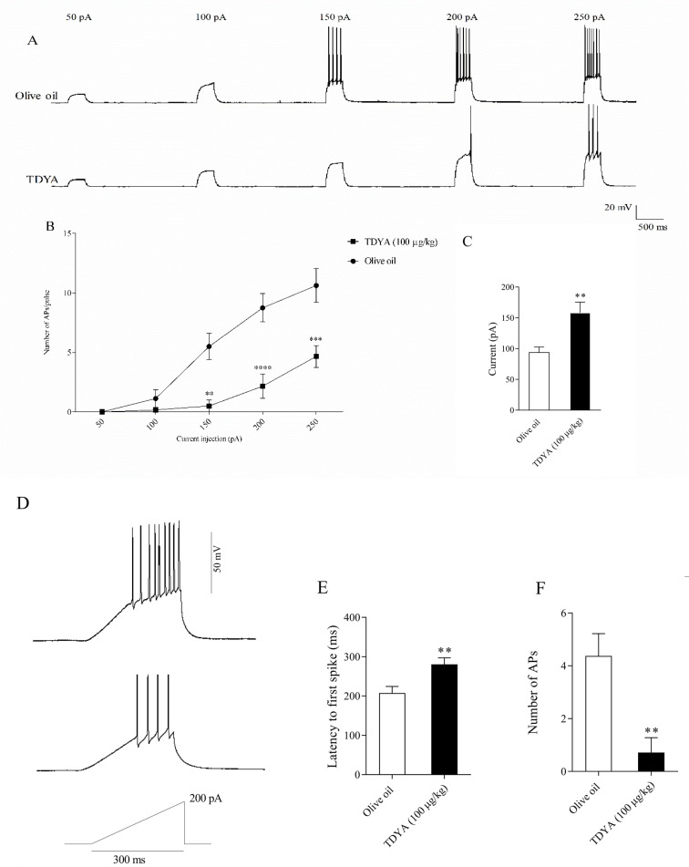 Hepatic Acyl CoA Oxidase1 Inhibition Modifies Brain Lipids and Electrical Properties of Dentate Gyrus.