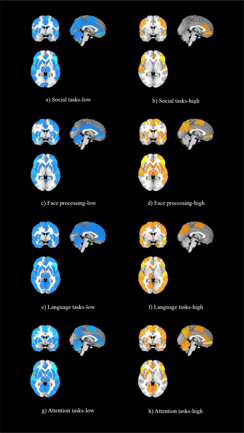 Examining the Dominant Presence of Brain Grey Matter in Autism During Functional Magnetic Resonance Imaging.