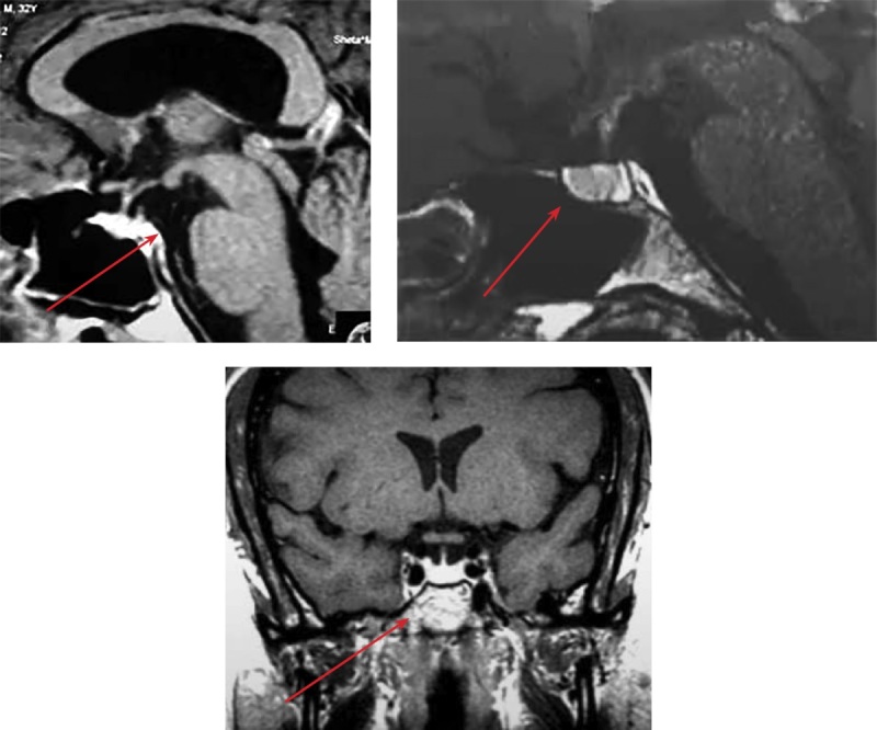 [Diagnosis of psychogenic polydipsia in the type of clinical case].