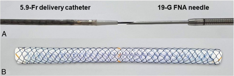Prospective clinical trial of EUS-guided choledochoduodenostomy without fistula dilation for malignant distal biliary obstruction.